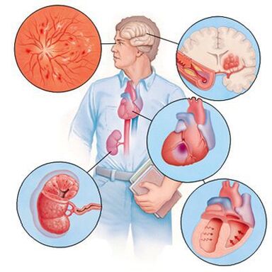 Cardiol zabraňuje rozvoju sprievodných ochorení